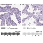 Merck Anti-CCDC151 antibody produced in rabbit