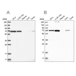 Merck Anti-AGPS antibody produced in rabbit
