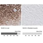 Merck Monoclonal Anti-GLS2 antibody produced in mouse