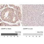Merck Anti-CENPF