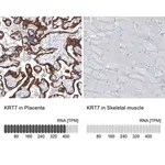 Merck Monoclonal Anti-KRT7 antibody produced in mouse