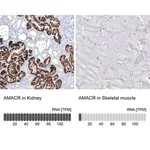 Merck Monoclonal Anti-AMACR antibody produced in mouse