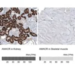 Merck Monoclonal Anti-AMACR antibody produced in mouse