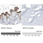Merck Monoclonal Anti-KRT20 antibody produced in mouse