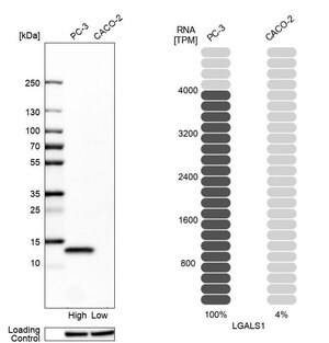 Merck Anti-LGALS1