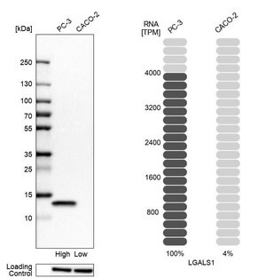 Merck Anti-LGALS1