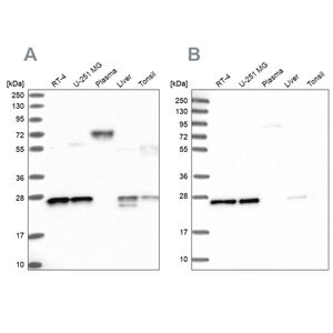 Merck Anti-MESDC2