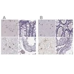 Merck Anti-CALCR antibody produced in rabbit