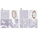 Merck Anti-GJA8 antibody produced in rabbit