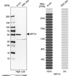 Merck Anti-KRT13 antibody produced in rabbit
