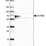 Merck Anti-ACVR2B antibody produced in rabbit