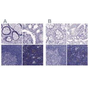 Merck Anti-PSMB11 antibody produced in rabbit