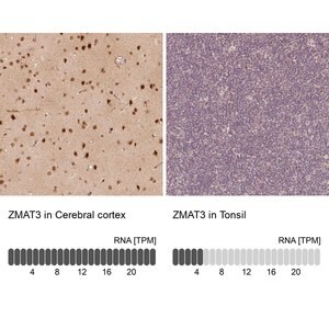 Merck Anti-ZMAT3