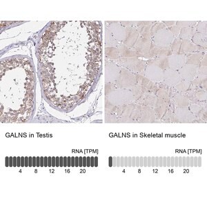 Merck Anti-GALNS