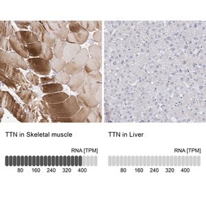 Merck Anti-TTN