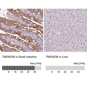 Merck Anti-TMEM236