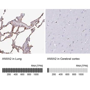 Merck Anti-ANXA2