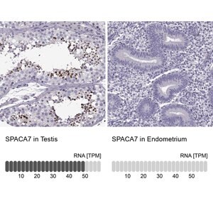 Merck Anti-SPACA7