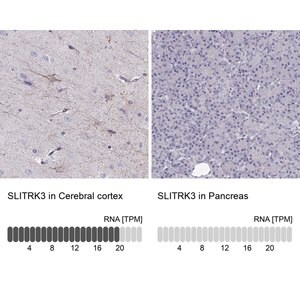 Merck Anti-SLITRK3