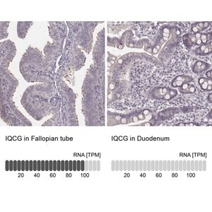 Merck Anti-IQCG