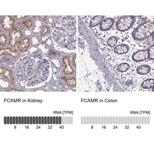 Merck Anti-FCAMR