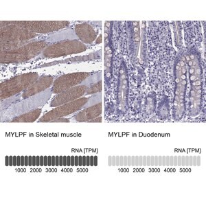 Merck Anti-MYLPF
