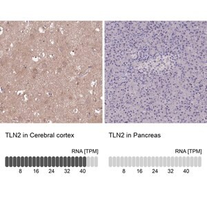 Merck Anti-TLN2