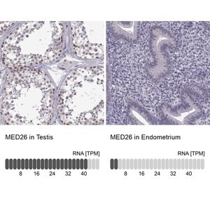 Merck Anti-MED26