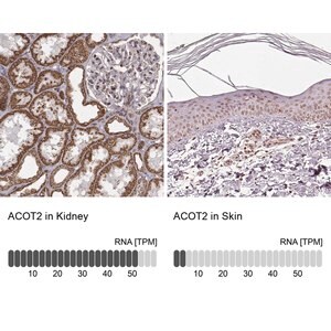 Merck Anti-ACOT2