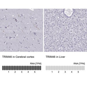Merck Anti-TRIM46