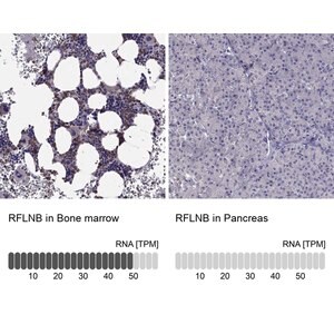 Merck Anti-RFLNB