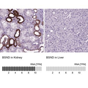 Merck Anti-BSND