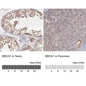 Merck Anti-BRCA1