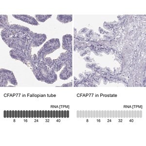 Merck Anti-CFAP77
