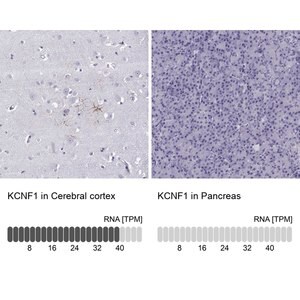 Merck Anti-KCNF1