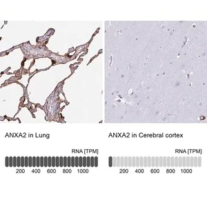 Merck Anti-ANXA2