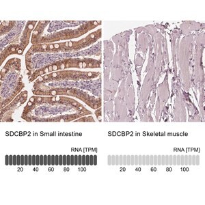 Merck Anti-SDCBP2