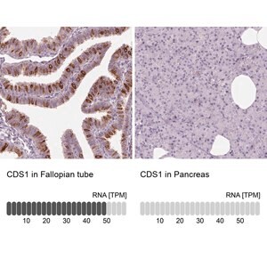 Merck Anti-CDS1