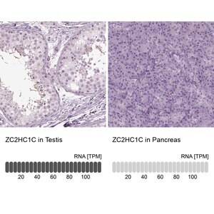 Merck Anti-ZC2HC1C