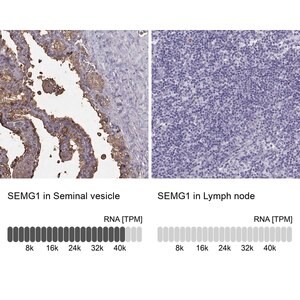 Merck Anti-SEMG1
