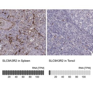 Merck Anti-SLC9A3R2