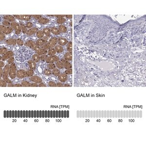 Merck Anti-GALM
