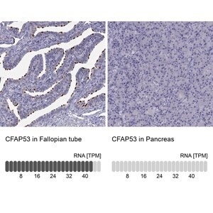 Merck Anti-CFAP53