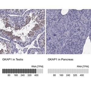 Merck Anti-GKAP1