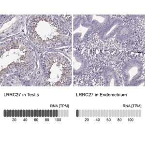 Merck Anti-LRRC27