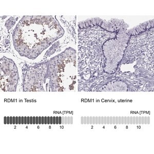 Merck Anti-RDM1