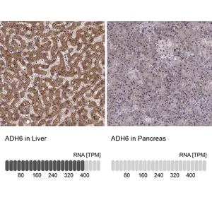 Merck Anti-ADH6