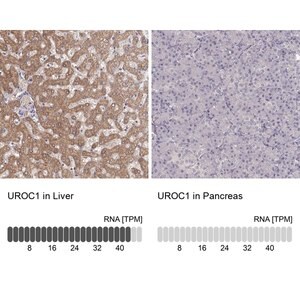 Merck Anti-UROC1