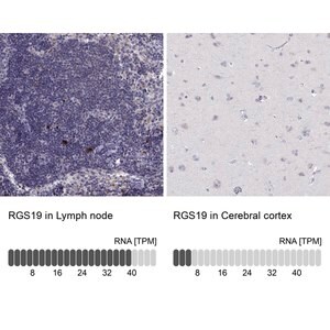 Merck Anti-RGS19