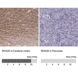 Merck Anti-RGS20